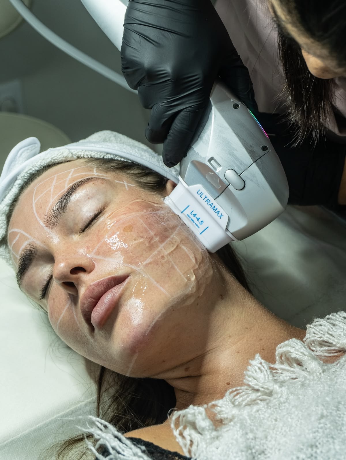Tratamiento HIFU facial en Diamante Beauty Studio